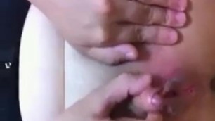 Huge Clitoris Comfortably Masturbation