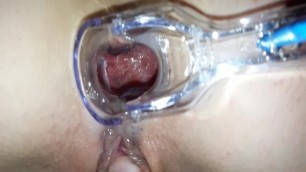 Medical but Plug Anal Enlarger Extender in as Deep