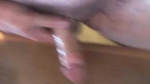 Stomach line cum