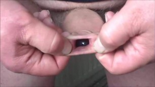 Foreskin with jar lid - 6 videos